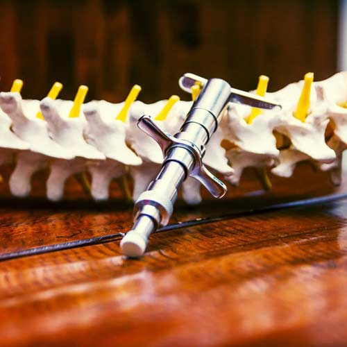 Torque Release Technique Instrument Used At Third Coast Chiropractic