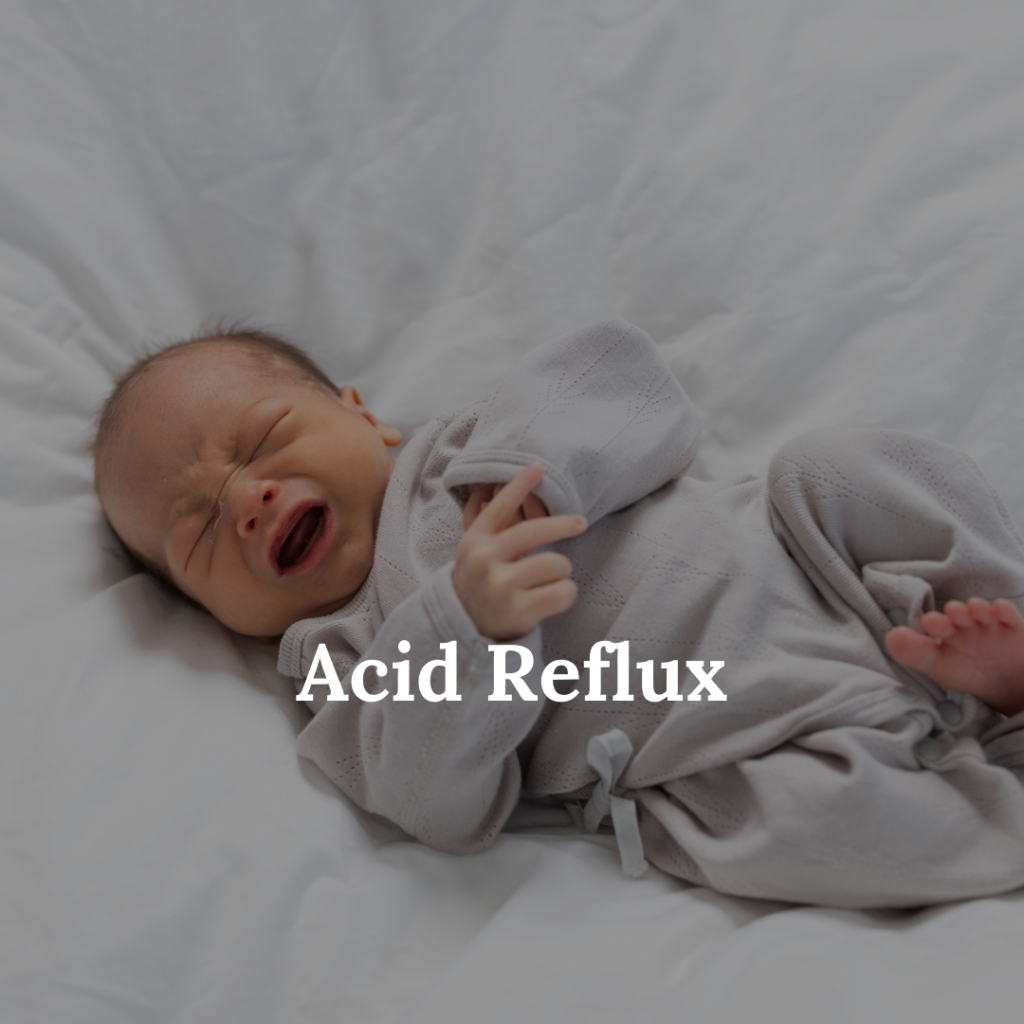 Acid Reflux In Babies