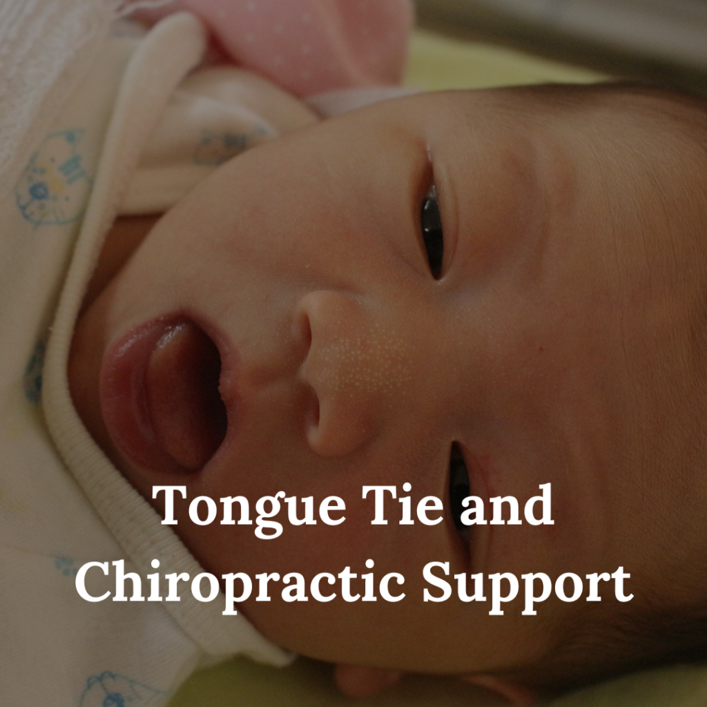Tongue Tie and Chiropractic Support