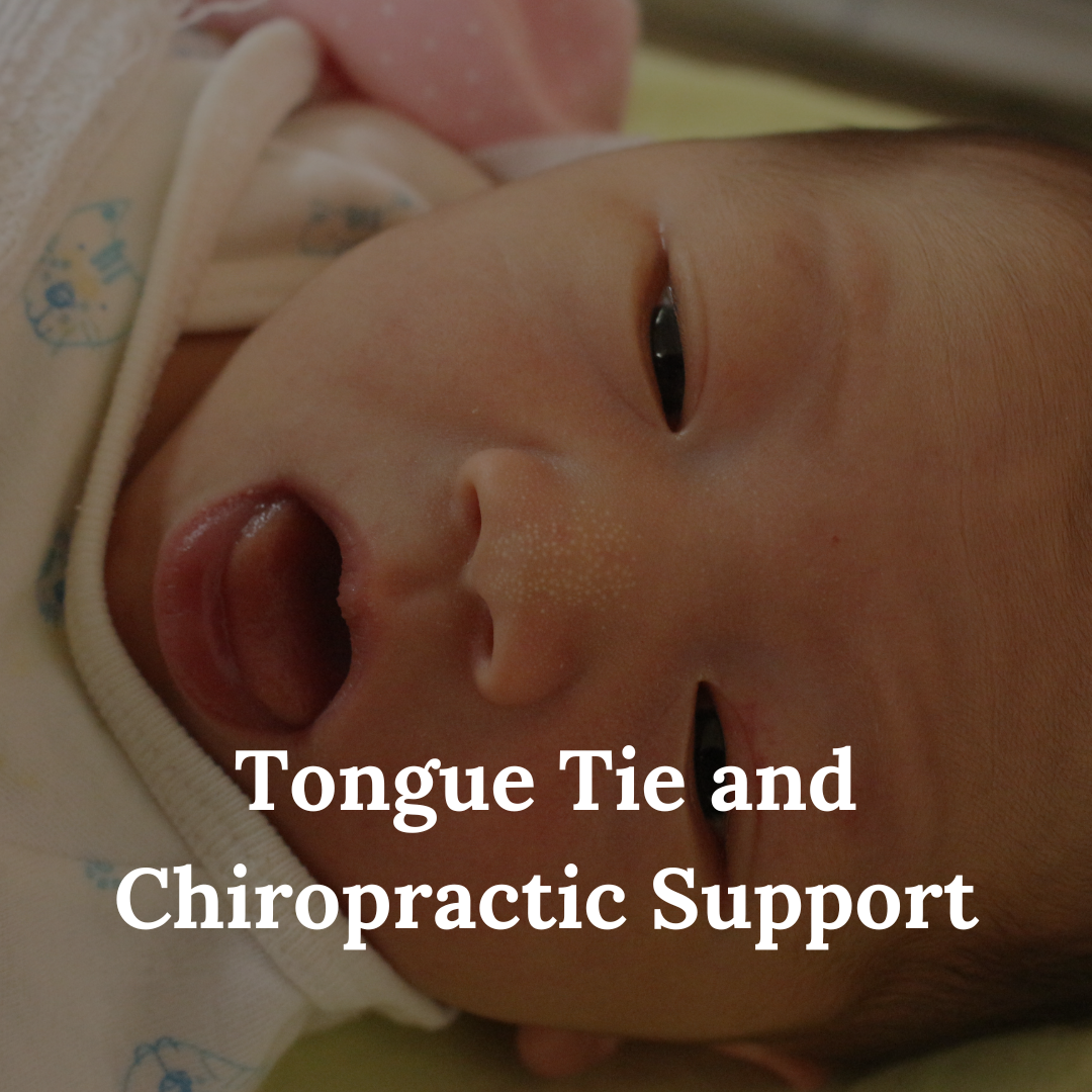 Tongue Tie and Chiropractic Support